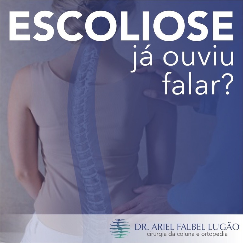 Médico explica: Escoliose, mais do que viver com a coluna aos 'ésses